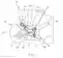 Fig. 02 - Anterolateral calcaneal plate