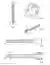 Fig. 02 - Medical device, apparatus, and surgical method