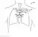 Fig. 01 - System and method for bronchial dilation