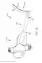 Fig. 02 - Adjustable clamp systems and methods