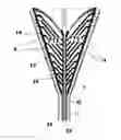 Fig. 01 - SYSTEMS AND METHODS FOR PERFORMING ENDOMETRIAL ABLATION
