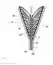 Fig. 02 - SYSTEMS AND METHODS FOR PERFORMING ENDOMETRIAL ABLATION