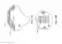 Fig. 16 - Surgical manipulator having a feed rate calculator