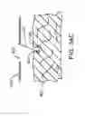 Fig. 49 - Surgical manipulator having a feed rate calculator