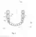 Fig. 02 - Orthodontic lingual device