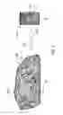 Fig. 05 - Compressed decalcified trabecular bone grafts and tooth socket repair