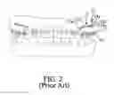 Fig. 03 - Orthodontic correction device