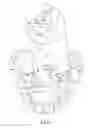 Fig. 04 - Orthodontic correction device
