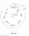 Fig. 06 - Orthodontic correction device