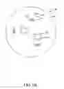 Fig. 07 - Orthodontic correction device