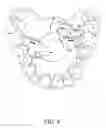 Fig. 11 - Orthodontic correction device