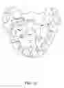 Fig. 12 - Orthodontic correction device