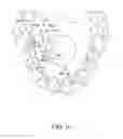 Fig. 18 - Orthodontic correction device