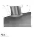 Fig. 04 - TOOTH VENEER ELEMENT, AND METHOD FOR THE USE AND PRODUCTION THEREOF