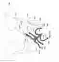 Fig. 19 - Pelvic floor repair system