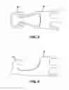 Fig. 07 - BLOOD FILTER WITH SCAFFOLDS CONFIGURED FOR EXTENDED IMPLANTED DURATION BEFORE RETRIEVAL