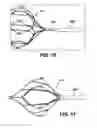 Fig. 10 - BLOOD FILTER WITH SCAFFOLDS CONFIGURED FOR EXTENDED IMPLANTED DURATION BEFORE RETRIEVAL