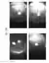 Fig. 40 - Prosthetic capsular devices, systems, and methods