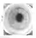 Fig. 49 - Prosthetic capsular devices, systems, and methods