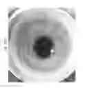 Fig. 64 - Prosthetic capsular devices, systems, and methods