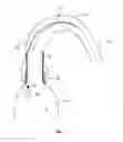 Fig. 02 - Prosthetic valve, delivery apparatus and delivery method