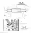 Fig. 06 - Surgical implantable stabilizer sling for basal joint arthroplasty