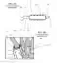 Fig. 07 - Surgical implantable stabilizer sling for basal joint arthroplasty