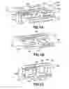 Fig. 02 - Plastically deformable inter-osseous device