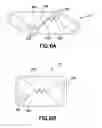Fig. 07 - Plastically deformable inter-osseous device