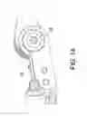 Fig. 09 - Prosthetic knee