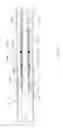 Fig. 04 - Balloon catheter for multiple adjustable stent deployment