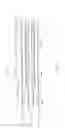 Fig. 09 - Balloon catheter for multiple adjustable stent deployment