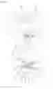 Fig. 08 - ORAL APPLIANCE
