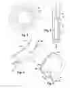 Fig. 02 - Pupil Expansion Device
