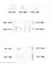 Fig. 03 - Intraocular delivery devices and methods therefor
