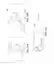 Fig. 14 - Intraocular delivery devices and methods therefor
