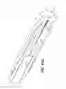 Fig. 28 - Intraocular delivery devices and methods therefor