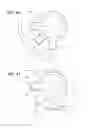 Fig. 34 - Intraocular delivery devices and methods therefor