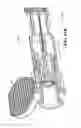 Fig. 47 - Intraocular delivery devices and methods therefor