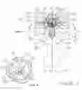 Fig. 03 - Device and method for delivering medicine into the tympanic cavity, with sliding assist