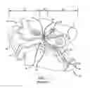 Fig. 02 - System and method for treatment of non-ventilating middle ear by providing a gas pathway through the nasopharynx