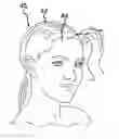 Fig. 01 - Scalp Scratching Assembly