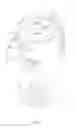 Fig. 05 - Vial shield
