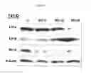 Fig. 02 - INDUCTION OF ESTROGEN RECEPTOR BETA BY CHOLESTEROL BIOSYNTHESIS INHIBITORS AND METHODS OF TREATMENT OF CANCER