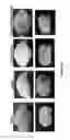 Fig. 35 - Salvinorin compositions and uses thereof