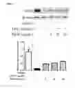 Fig. 06 - (+)-3′-angeloyloxy-4′-keto-3′,4′-dihydroseselin for treating inflammation