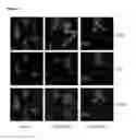 Fig. 07 - (+)-3′-angeloyloxy-4′-keto-3′,4′-dihydroseselin for treating inflammation