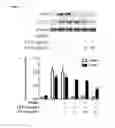Fig. 08 - (+)-3′-angeloyloxy-4′-keto-3′,4′-dihydroseselin for treating inflammation