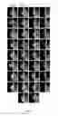 Fig. 06 - Compositions and methods for treating bone diseases and broken bones