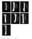 Fig. 08 - Compositions and methods for treating bone diseases and broken bones